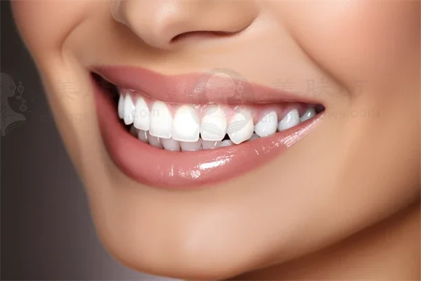 牙齿美白优惠盛宴：威海宇建口腔门诊部原价999元起，现在仅需799元起，让您在享受专業服务的同时，体验真正的优惠！