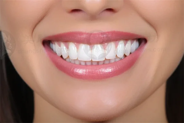 岳阳地区牙科医院排名前十，平江致远口腔预防所牙齿美白项目值得信赖，结果显著！