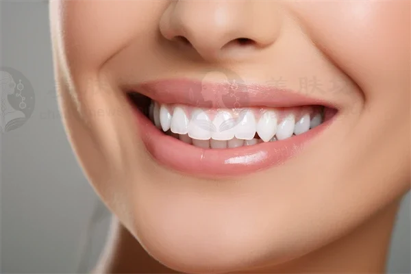 轻松呵护口腔健康，武汉大众口腔(杨园店)的口腔预防保健现仅需199元起，原价299元起，优惠力度不容错过！