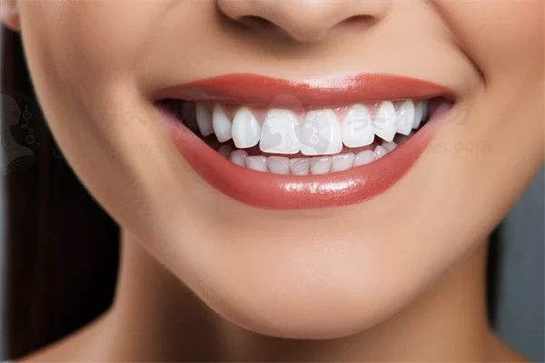 福州维乐口腔(台江中亭街店)补牙收费现仅需480元起，原价600元起，限时优惠，抓住机会！