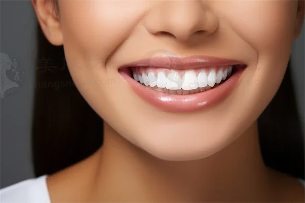 东莞长安霄边固美口腔门诊部烤瓷牙优惠活动，现仅需2400元起，原价3000元起，抓住机会，快来体验吧！