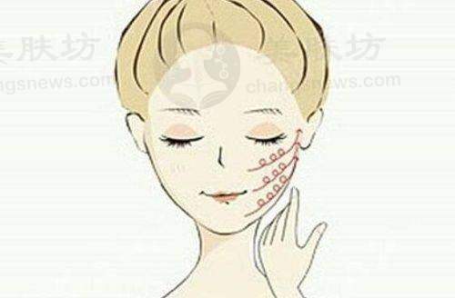 在韩面部松弛下垂怎么选？韩国Theia与凯丽雅超声刀/onda提升详解