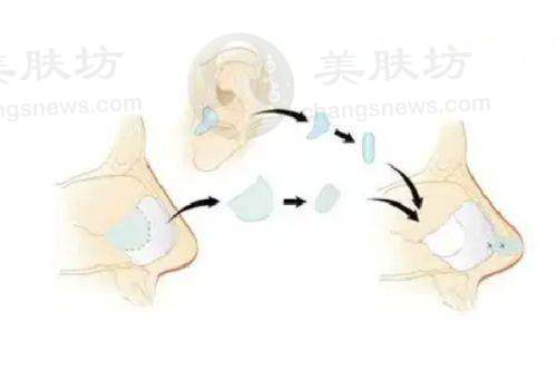 常见问题与认知澄清