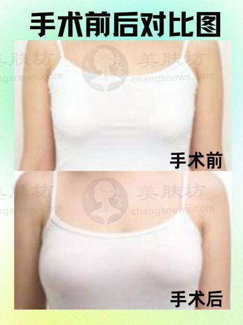 详细解读/优势分析