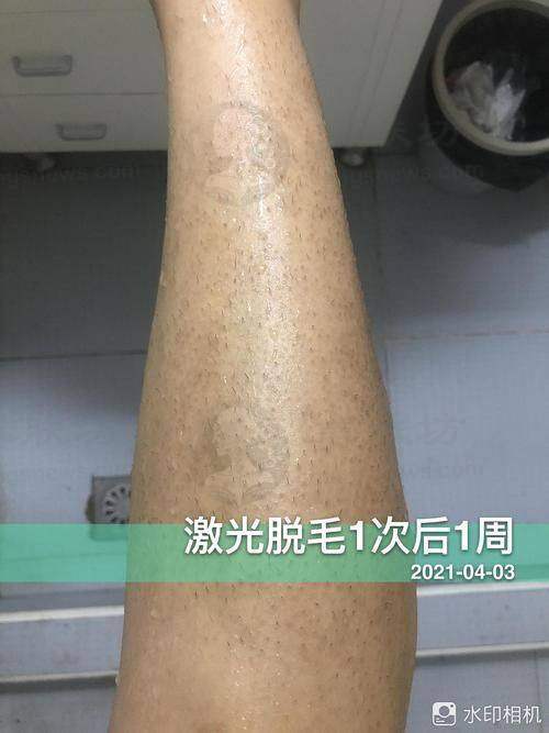 常见问题与认知澄清