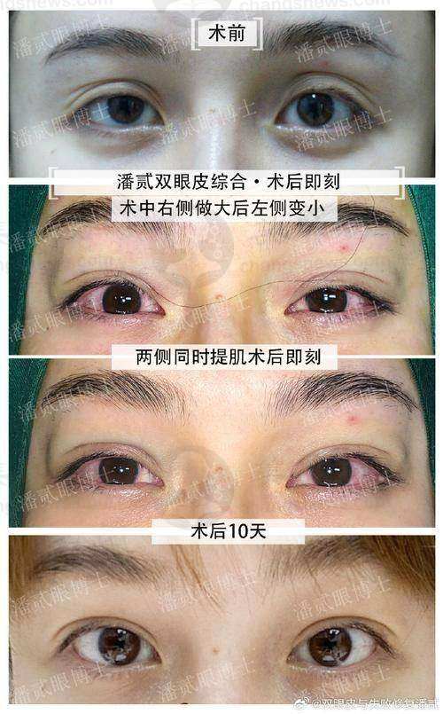 无锡尚美整形医院