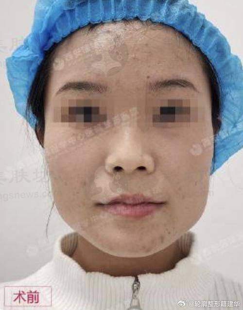 优惠活动详情