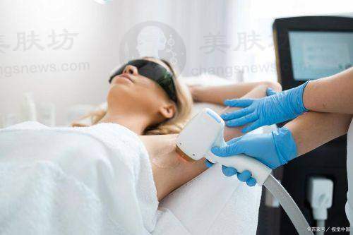 优惠活动详情