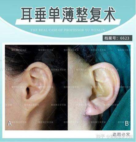 优惠活动详情