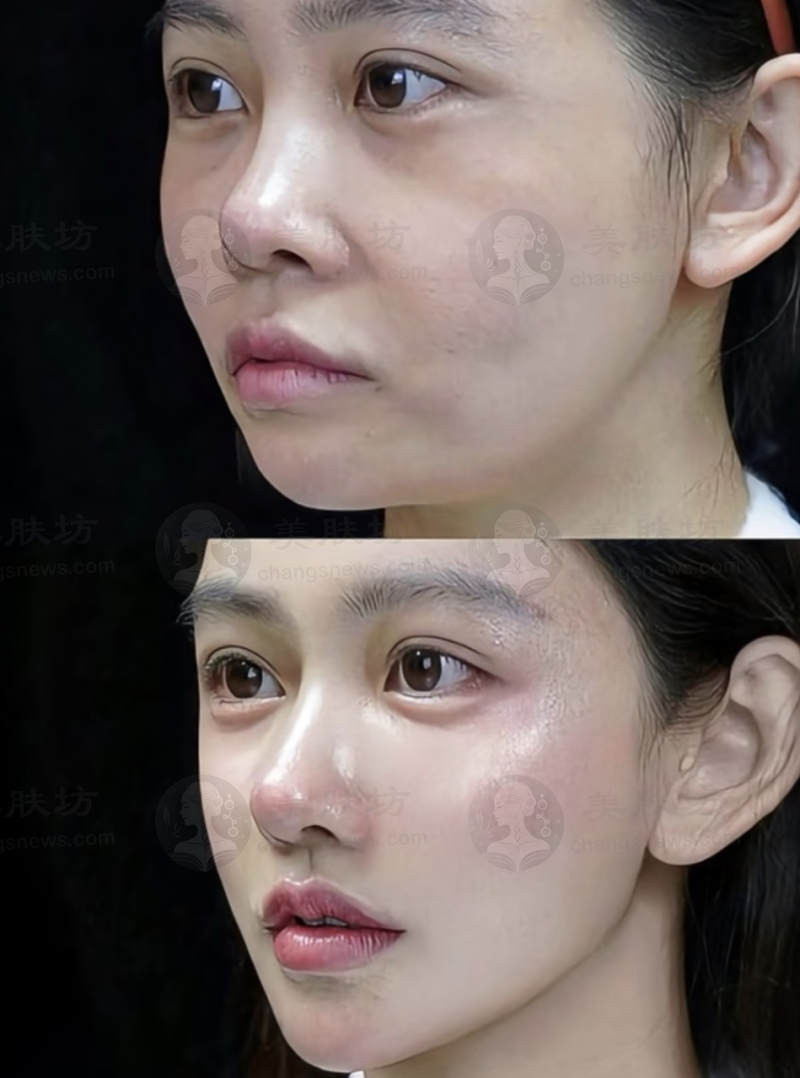 患者真实评价