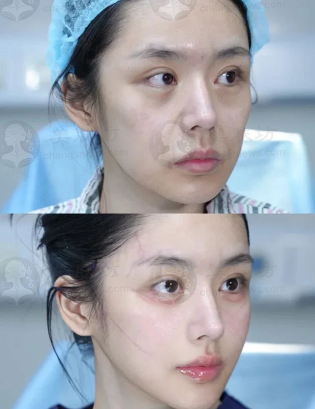 预约优惠活动