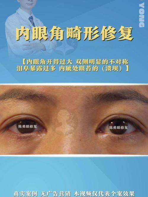 优惠活动详情